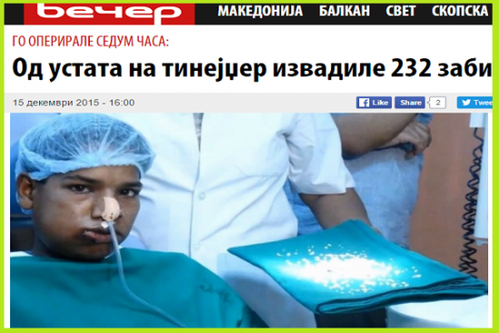 Од устата на тинејџер извадиле 232 заб_ - http___vecer.mk_life_od-ustata-na- 1