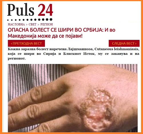FireShot Screen Capture #228 - 'Пулс 24 - ОПАСНА БОЛЕСТ СЕ ШИРИ ВО СРБИЈА_ И во Македонија може да се појави!' - puls24_mk_svet_region_opasna-bolest-s